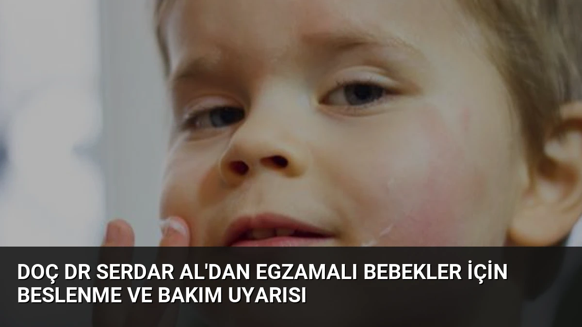 Doç Dr Serdar Al’dan Egzamalı Bebekler İçin Beslenme ve Bakım Uyarısı