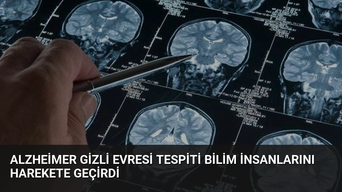 Alzheimer Gizli Evresi Tespiti Bilim İnsanlarını Harekete Geçirdi