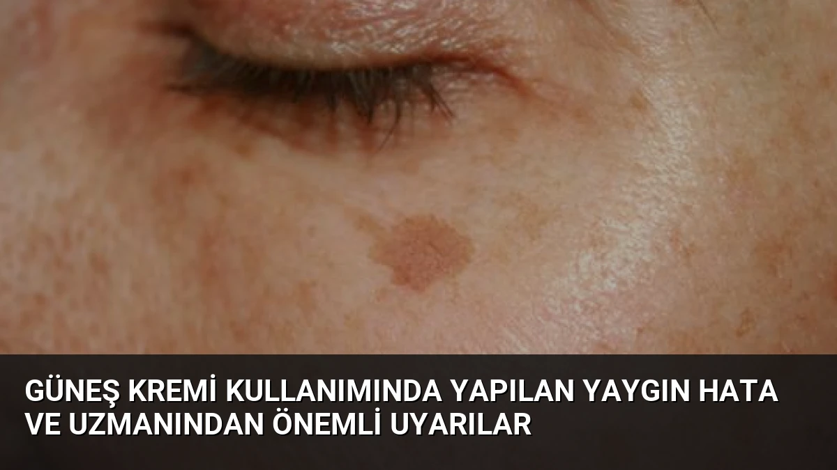 Güneş Kremi Kullanımında Yapılan Yaygın Hata ve Uzmanından Önemli Uyarılar