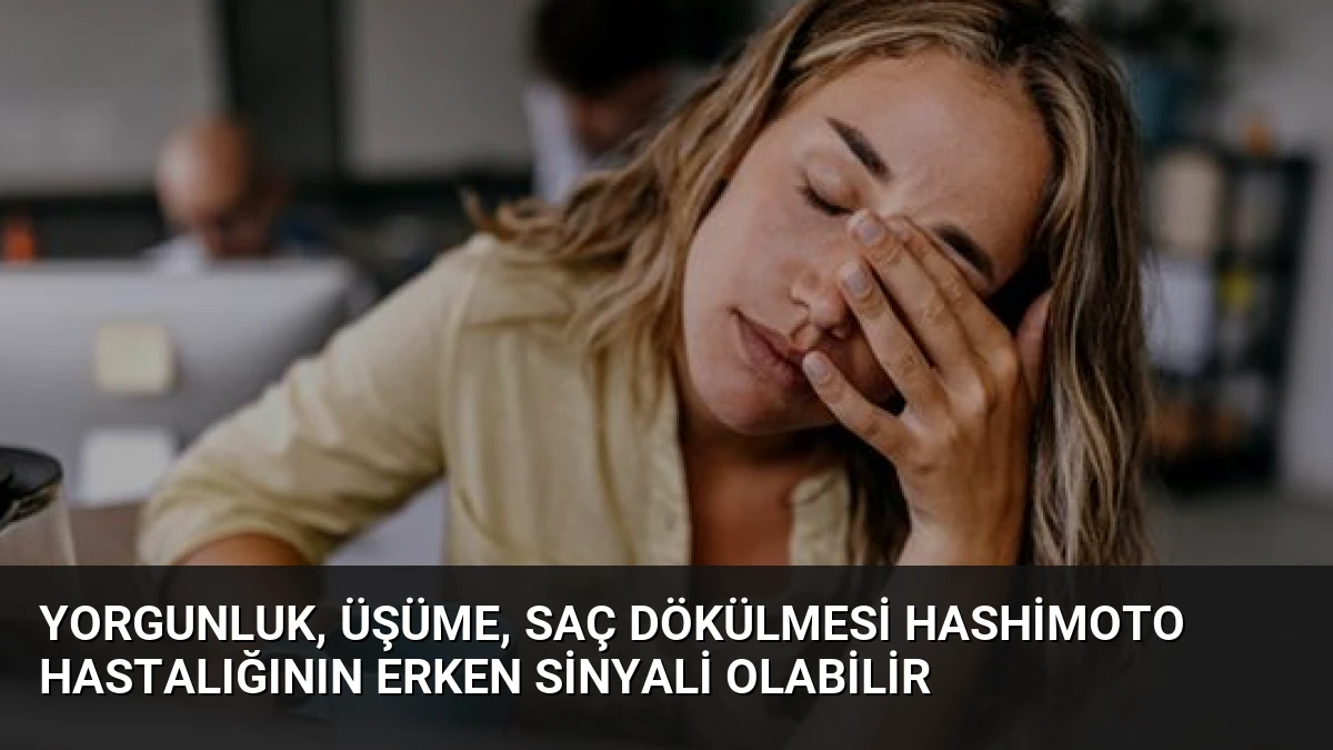 Yorgunluk, Üşüme, Saç Dökülmesi Hashimoto Hastalığının Erken Sinyali Olabilir