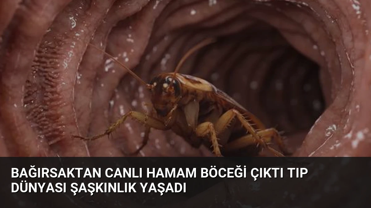 Bağırsaktan Canlı Hamam Böceği Çıktı Tıp Dünyası Şaşkınlık Yaşadı