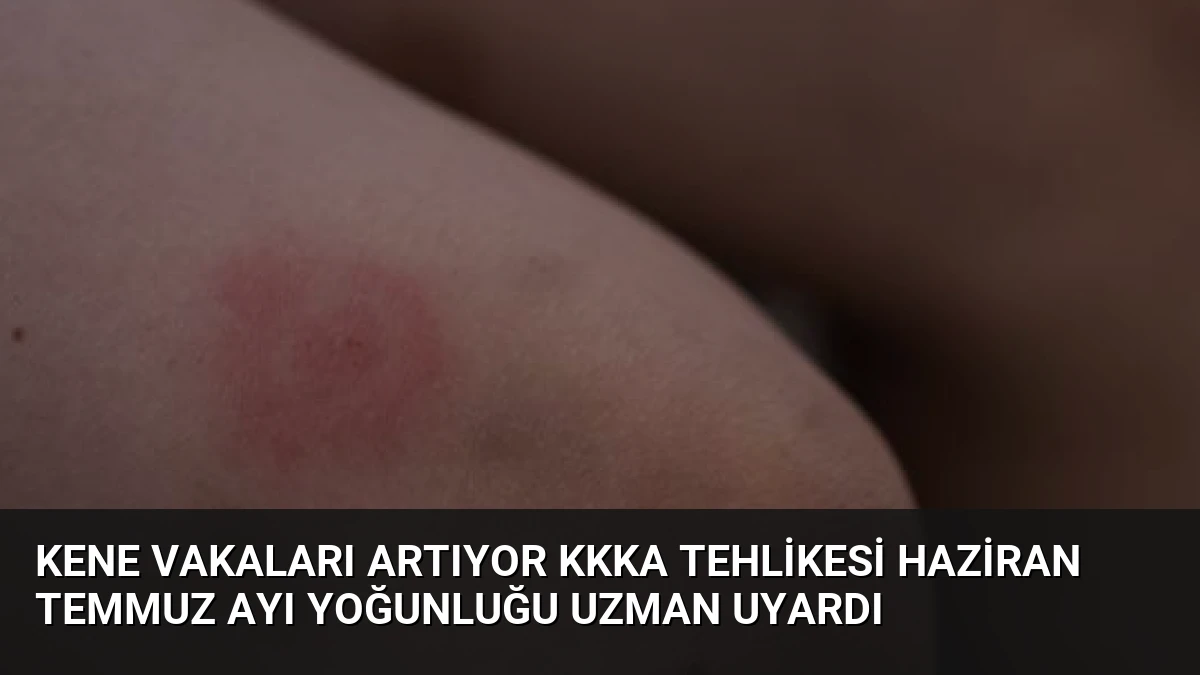 Kene Vakaları Artıyor KKKA Tehlikesi Haziran Temmuz Ayı Yoğunluğu Uzman Uyardı