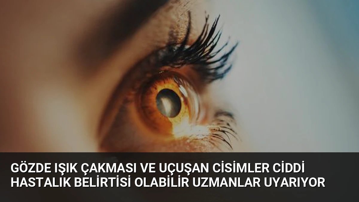 Gözde Işık Çakması ve Uçuşan Cisimler Ciddi Hastalık Belirtisi Olabilir Uzmanlar Uyarıyor