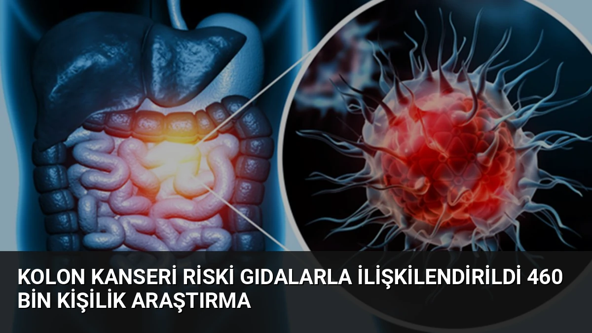 Kolon Kanseri Riski Gıdalarla İlişkilendirildi 460 Bin Kişilik Araştırma