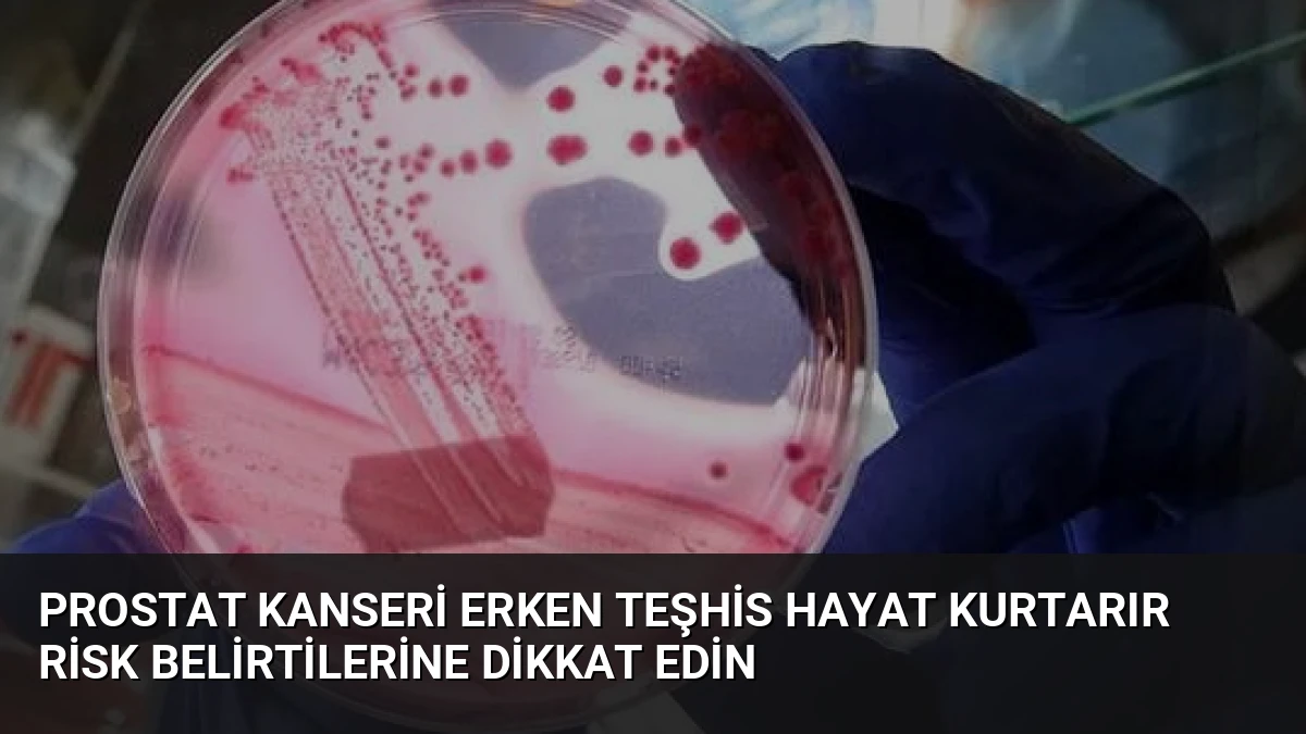 Prostat Kanseri Erken Teşhis Hayat Kurtarır Risk Belirtilerine Dikkat Edin